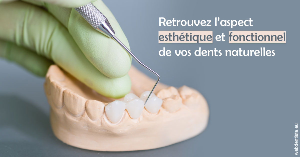 https://dr-bensoussan-sylvie.chirurgiens-dentistes.fr/Restaurations dentaires 1