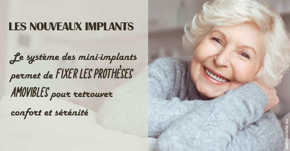 https://dr-bensoussan-sylvie.chirurgiens-dentistes.fr/Les nouveaux implants 1