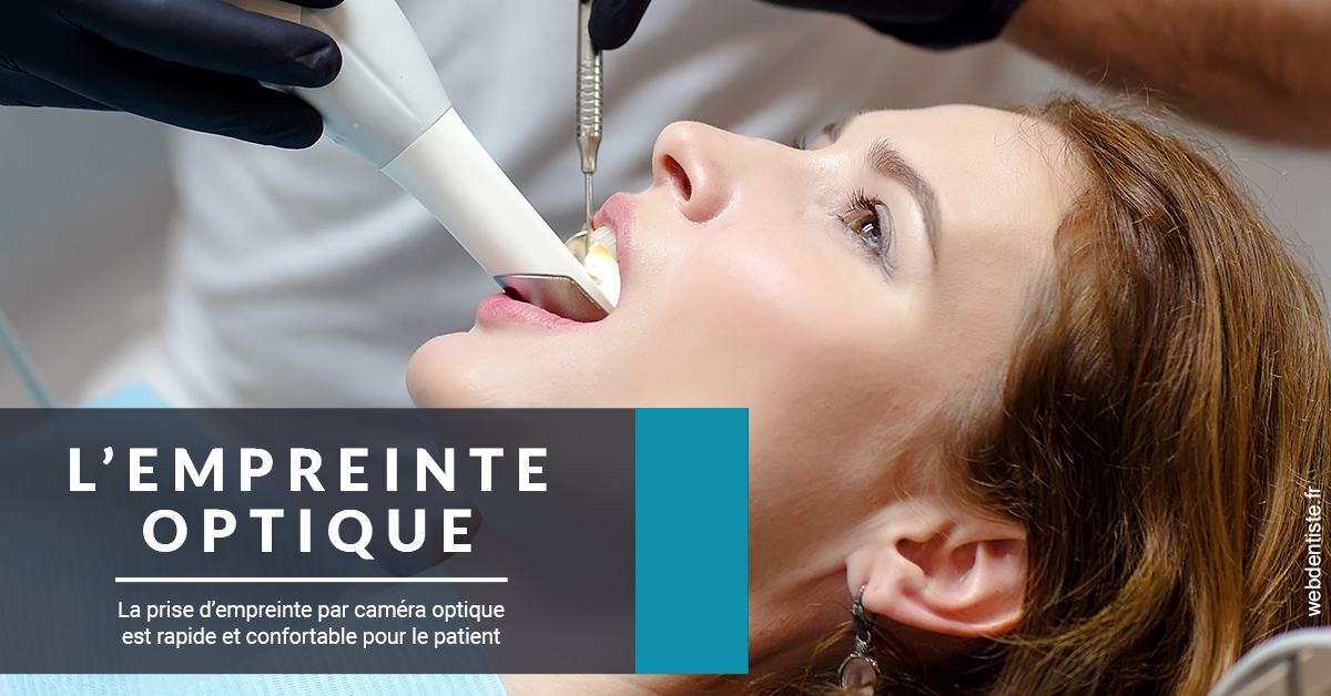 https://dr-bensoussan-sylvie.chirurgiens-dentistes.fr/L'empreinte Optique 1