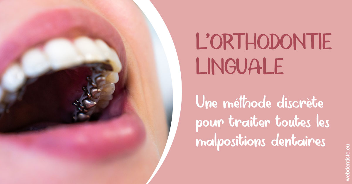 https://dr-bensoussan-sylvie.chirurgiens-dentistes.fr/L'orthodontie linguale 2