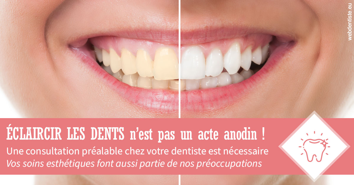 https://dr-bensoussan-sylvie.chirurgiens-dentistes.fr/Eclaircir les dents 1