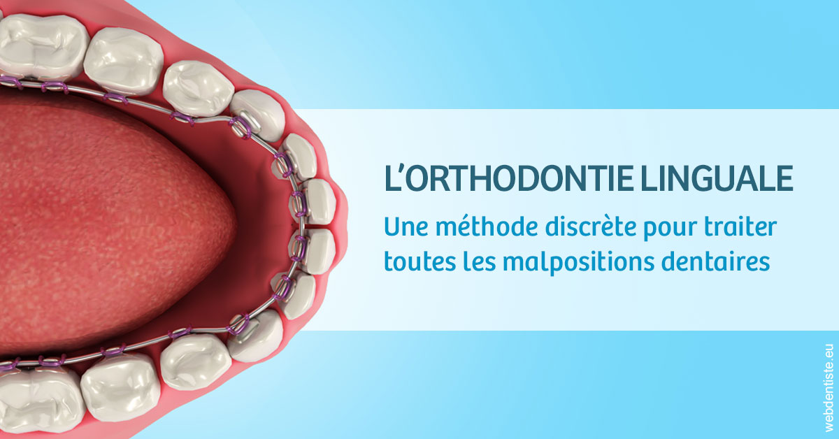 https://dr-bensoussan-sylvie.chirurgiens-dentistes.fr/L'orthodontie linguale 1