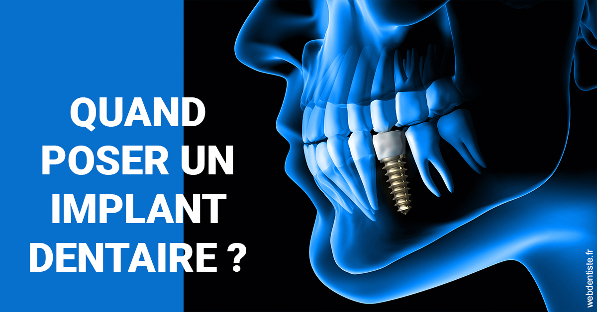 https://dr-bensoussan-sylvie.chirurgiens-dentistes.fr/Les implants 1
