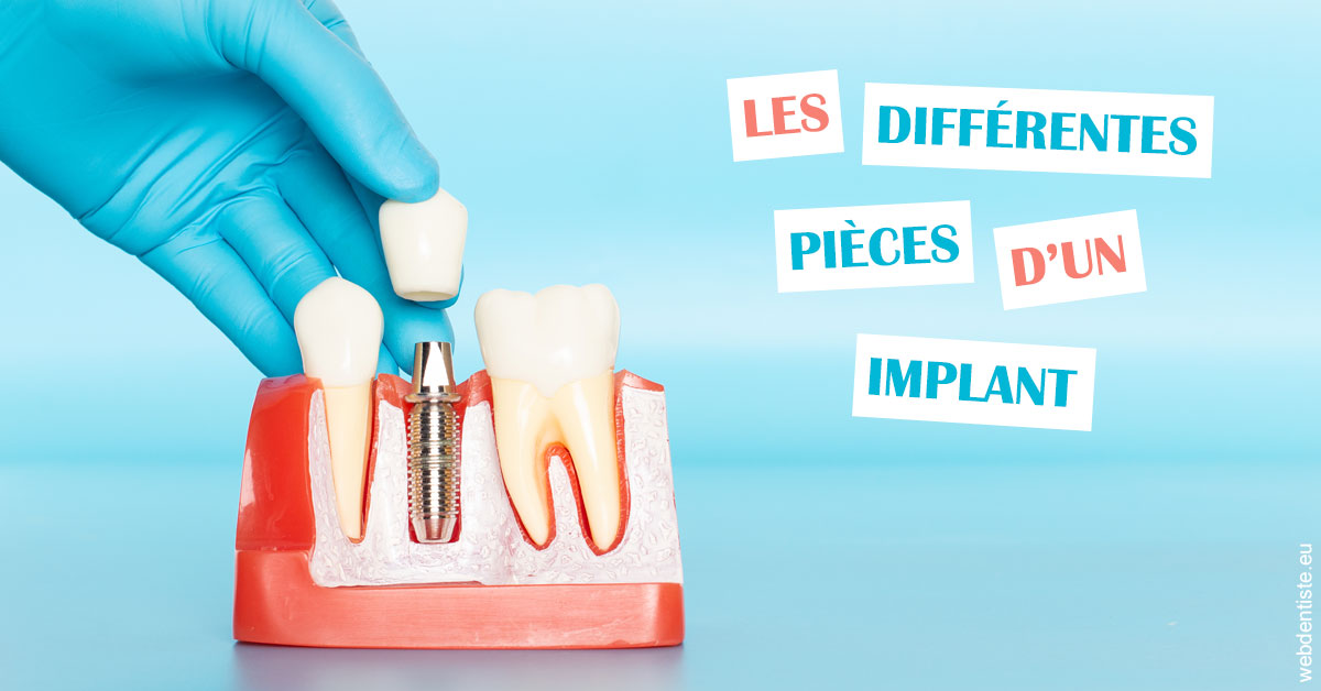 https://dr-bensoussan-sylvie.chirurgiens-dentistes.fr/Les différentes pièces d’un implant 2