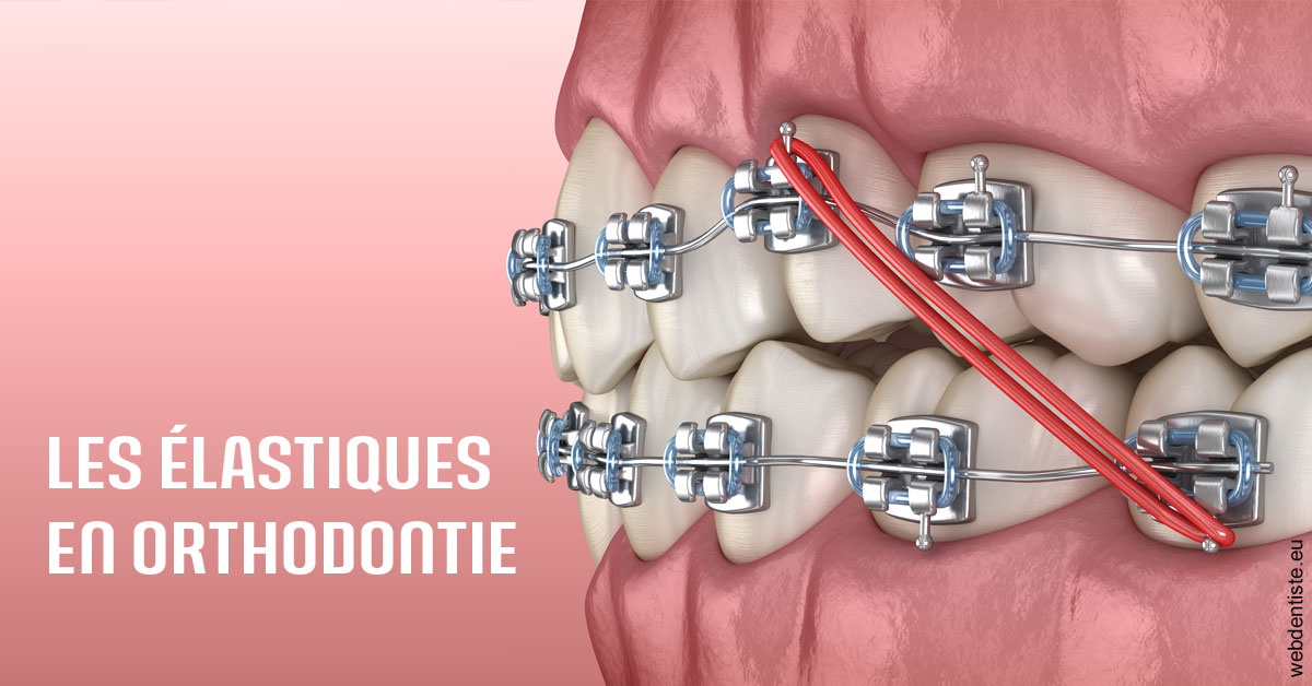 https://dr-bensoussan-sylvie.chirurgiens-dentistes.fr/Elastiques orthodontie 2