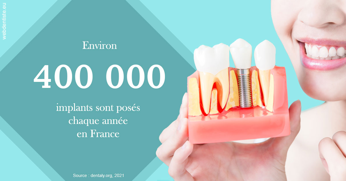 https://dr-bensoussan-sylvie.chirurgiens-dentistes.fr/Pose d'implants en France 2